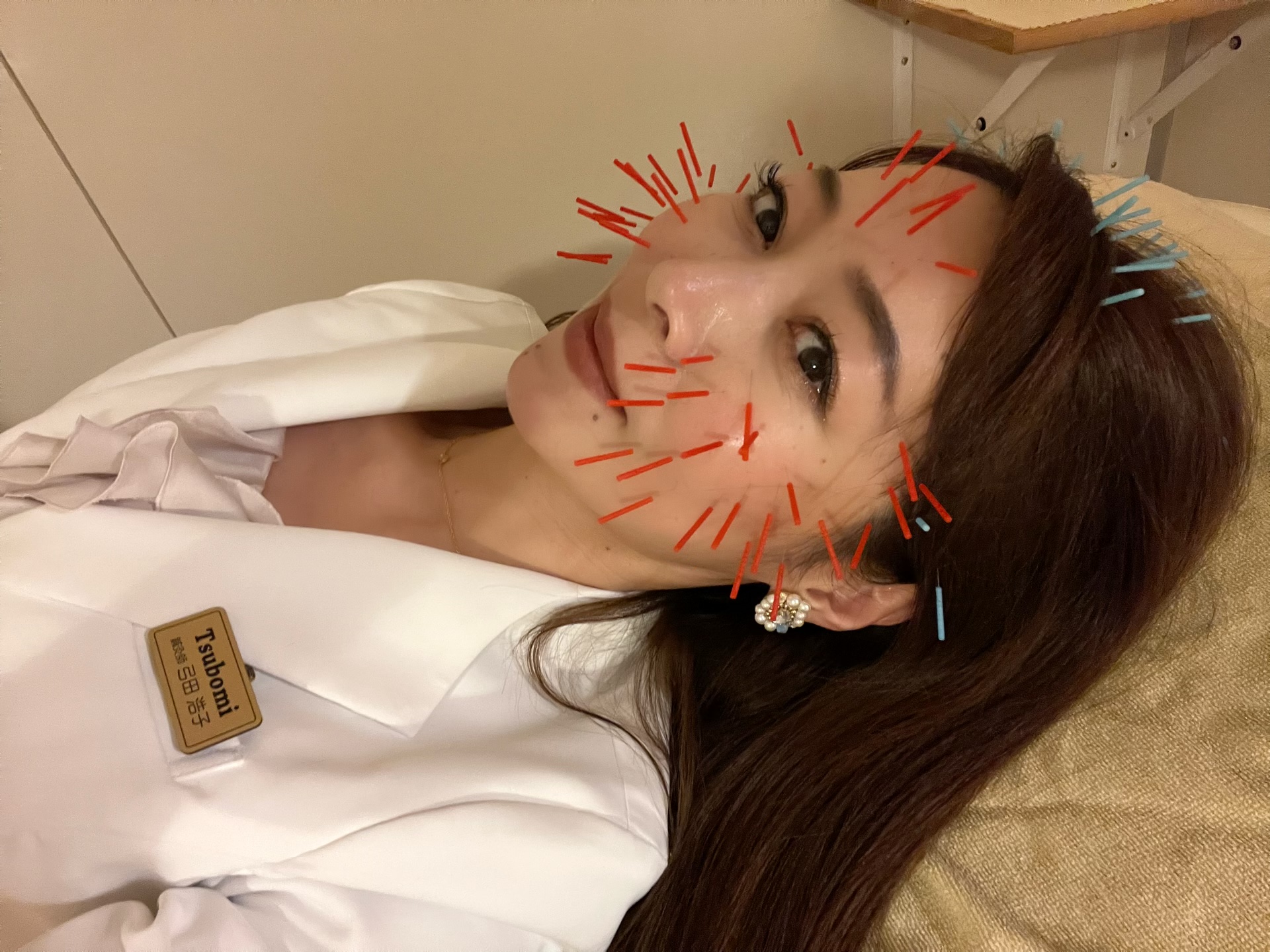 耳つぼ てい鍼(鍉鍼) 頭痛 美容 鍼灸 美顔 通販 耳つぼ てい鍼(鍉鍼) 頭痛 美容 鍼灸 美顔